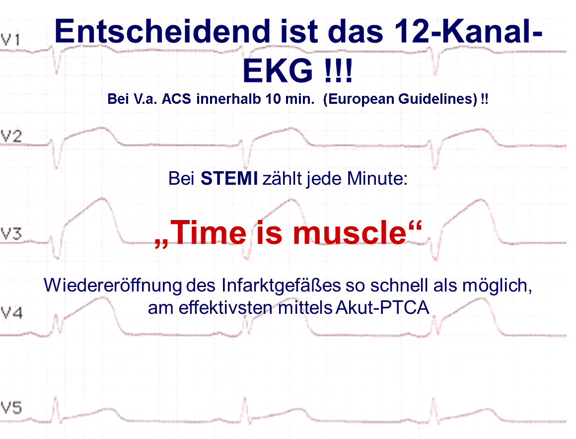 12 Kanal Ableitung 12 Kanal Ableitung